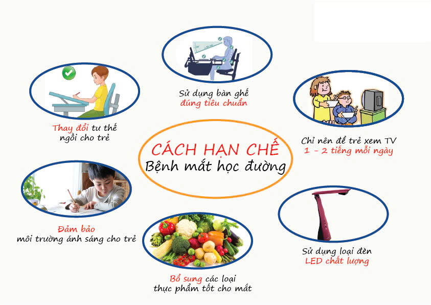 Cách chống cận thị với đèn led cực hiệu quả năm 2024